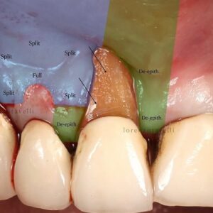 PERIOPLASTIC SURGERY (5th - 6th FEBRUARY 2027)